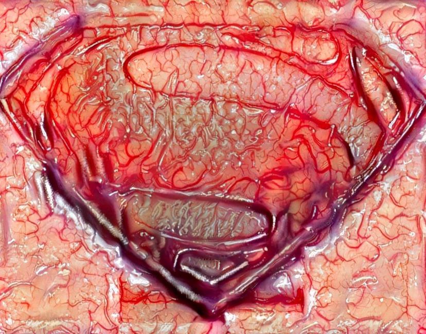 Nft Superman review #002