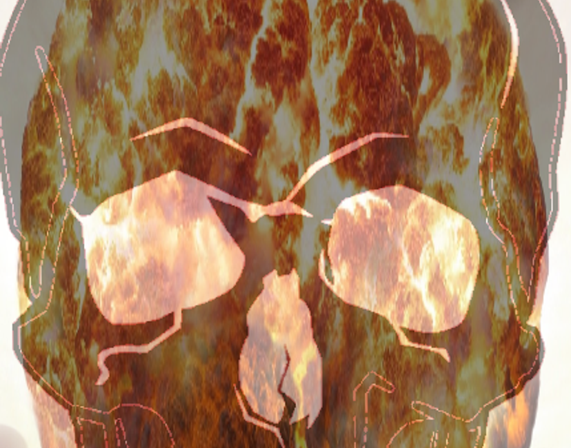Nft DeadSkulNuclearBlast
